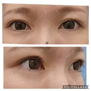 7 days after image