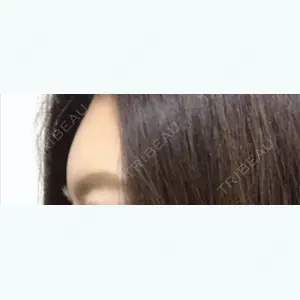 4 days after image