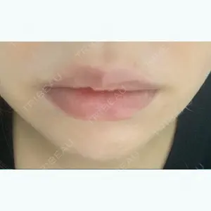 id美容外科の口コミ