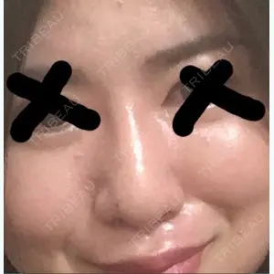671 days after image