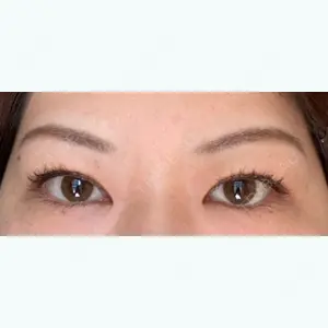 ツツイ美容外科の筒井 康文医師口コミ