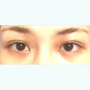 79 days after image