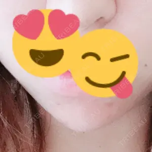 口コミ