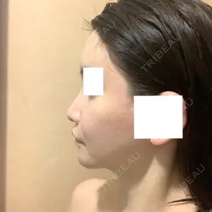 ビューティーライン美容外科口コミ
