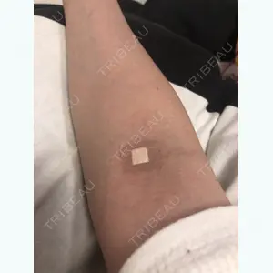 0 days after image