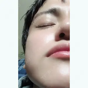 93 days after image