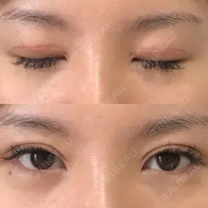 28 days after image