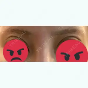 878 days after image