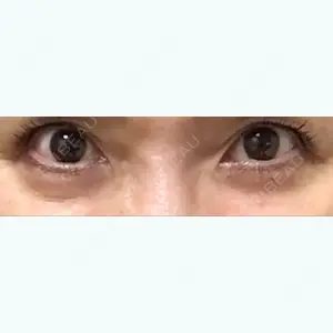 二子玉川美容外科クリニック口コミ