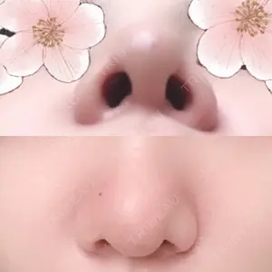 2 days after image