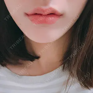 1 days after image