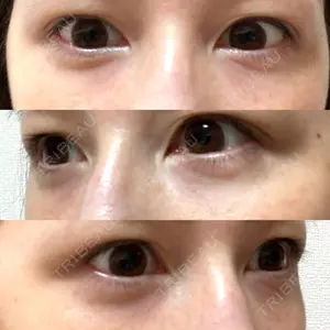 892 days after image