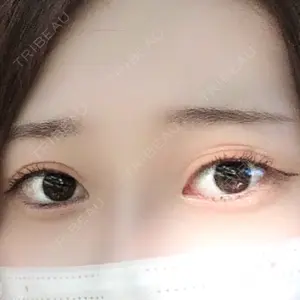 920 days after image
