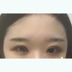 ブリスクリニック形成外科・美容外科・美容皮膚科福岡口コミ