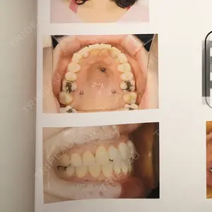 701 days after image
