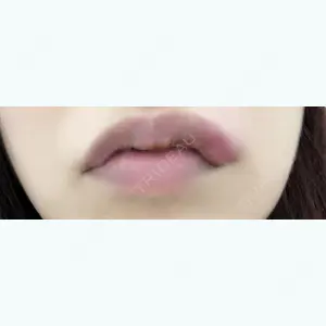 5 days after image