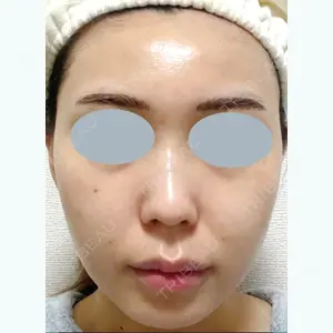 藤・ナチュレ美容クリニック 藤ナチュレスキンクリニック口コミ