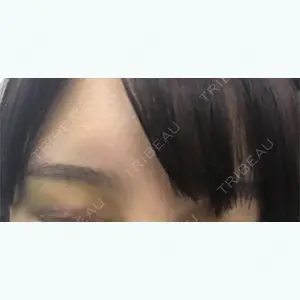 7 days after image