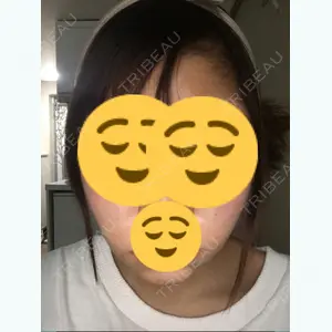 3 days after image