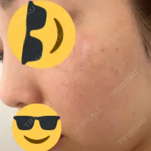 39 days after image