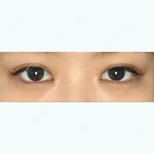 197 days after image