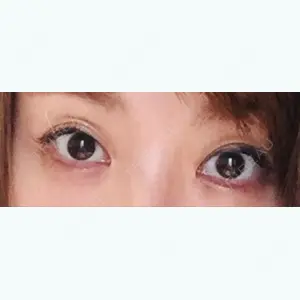 105 days after image