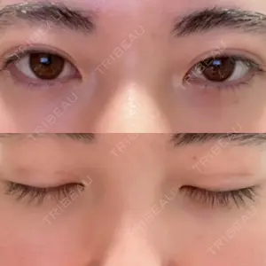 高須クリニック 高須クリニック 名古屋院口コミ