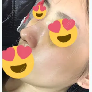 12 days after image