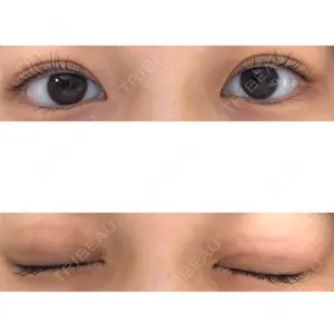 29 days after image