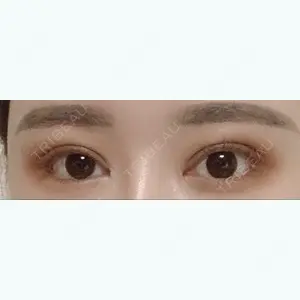 Lovelyan整形外科口コミ