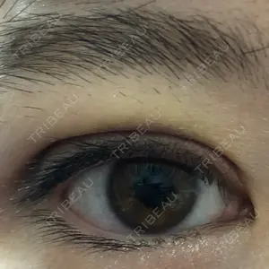 9 days after image