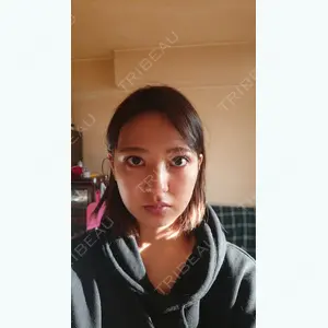 39 days after image