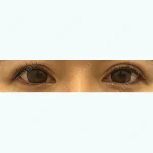 品川美容外科福岡院の吉池 剛医師口コミ