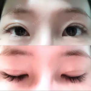 26 days after image