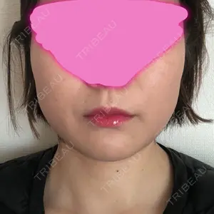 15 days after image