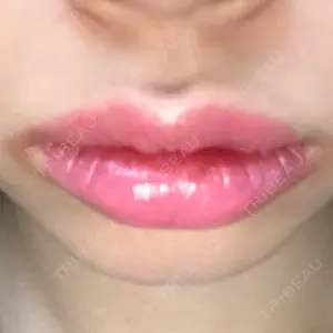 22 days after image