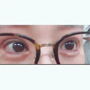0 days after image