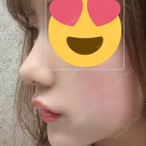 13 days after image