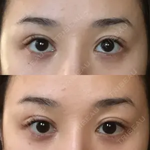 88 days after image