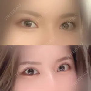 1006 days after image