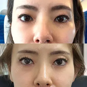 新宿ラクル美容外科クリニックの口コミ