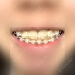 カトレア歯科・美容クリニック（旧クローバー歯科・美容クリニック輪郭整形部門）口コミ