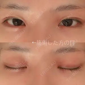 13 days after image