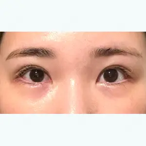 80 days after image