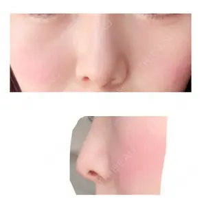 324 days after image