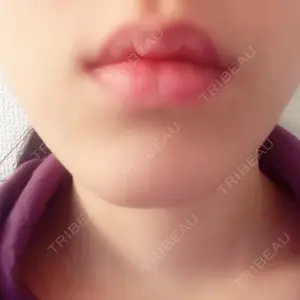 聖心美容クリニック 大阪院の杉原 真梨子医師口コミ