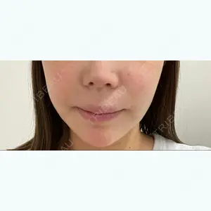 エイペックス美容外科のソンヒョンソク医師口コミ