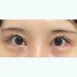 エイペックス美容外科のソンヒョンソク医師口コミ
