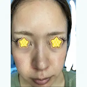 東京素肌クリニックの口コミ