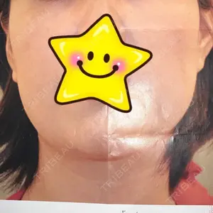 85 days after image